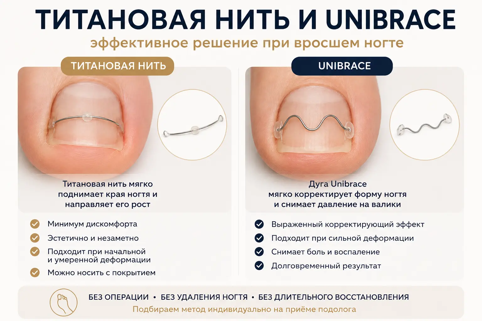 Коррекционная система на ногте
